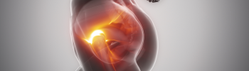 Aliviando el dolor de cadera: fisioterapia para la sacroileitis Aliviando el dolor de cadera: fisioterapia para la sacroileitis