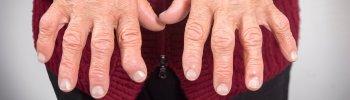 Fisioterapia para pacientes con artritis: Mejorando la movilidad y reduciendo el dolor