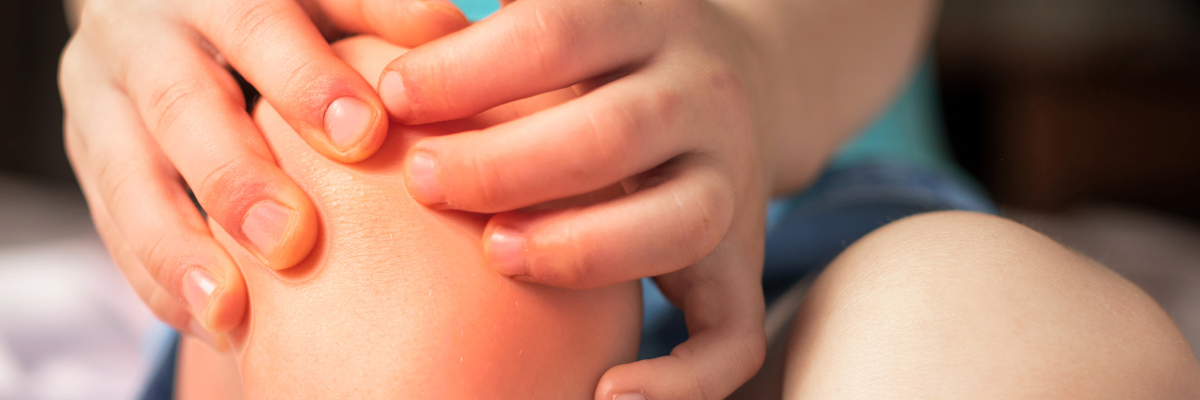 Gestión del dolor en niños: tratando los síndromes de Sever y Osgood-Schlatter con fisioterapia