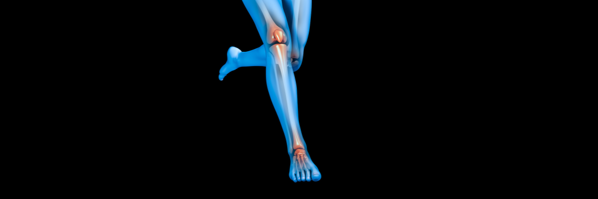 Fisioterapia para la periostitis tibial: tratamiento y prevención en corredores