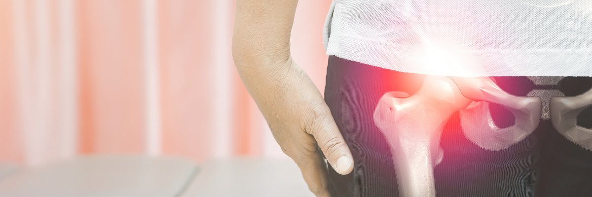 Fisioterapia para la displasia de cadera en adultos: tratamiento y ejercicios recomendados
