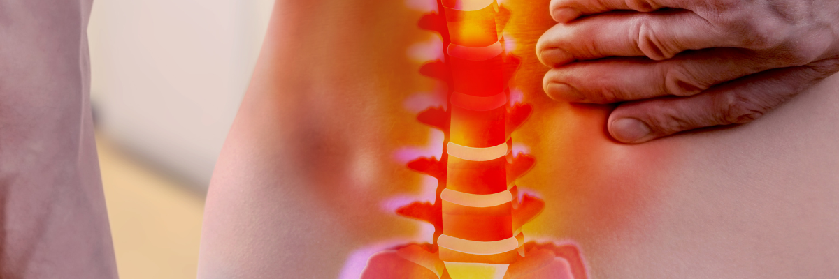 "Radiofrecuencia Indiba y lumbalgia: Alivio efectivo para el dolor de espalda"