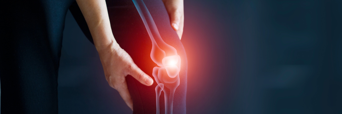 Tratamiento fisioterapéutico para el síndrome de la cintilla iliotibial en corredores